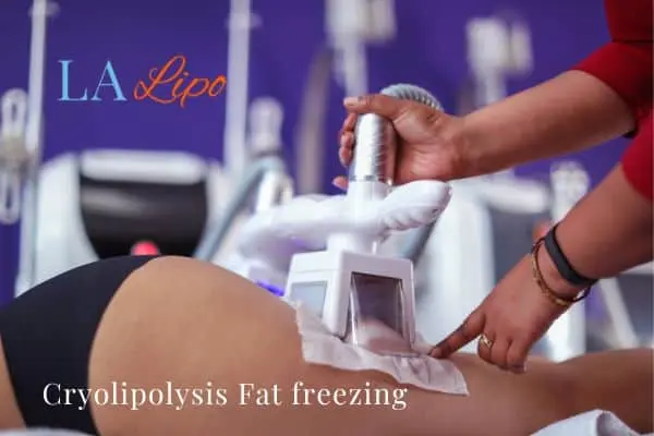 women getting fat freezing King's Lynn