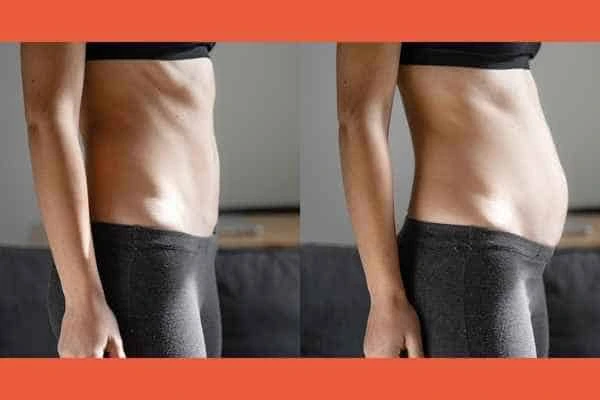 LA-EMS Body Sculpting results King's Lynn