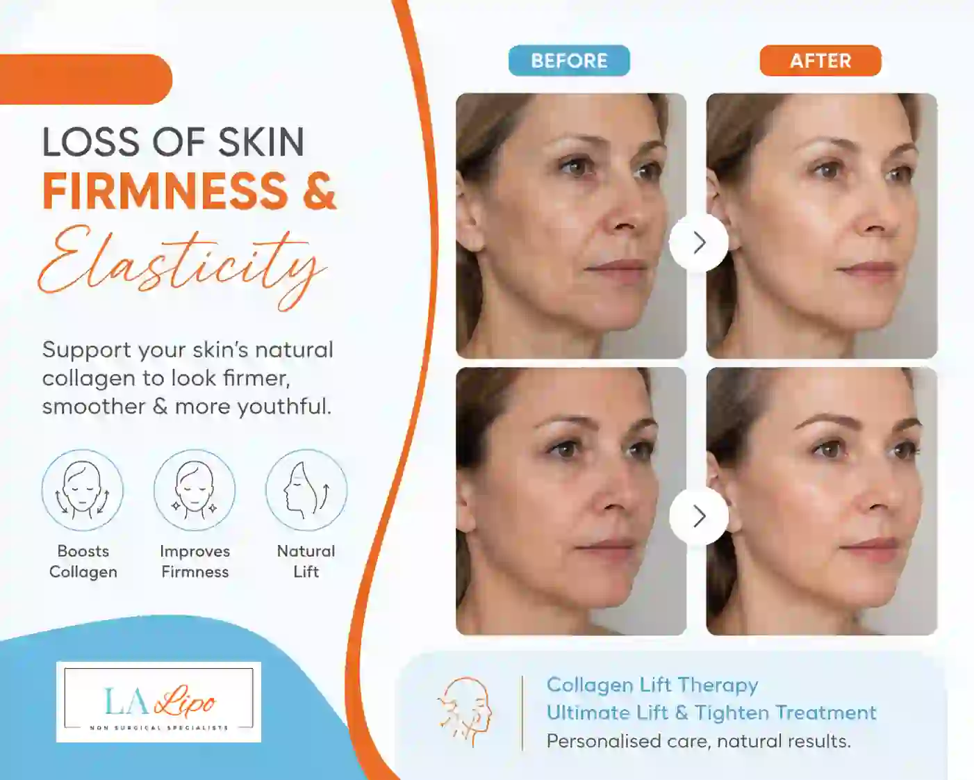 Sign #7: Loss of Skin Firmness and Elasticity King's Lynn